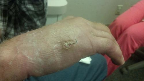 pin in hand.jpg